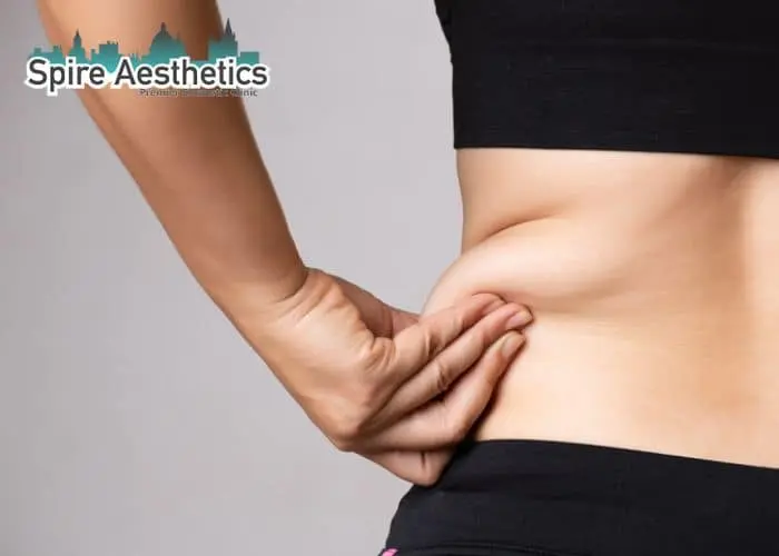 Image of woman pinching fat on their hips Rutherglen. Fat Freezing treatment