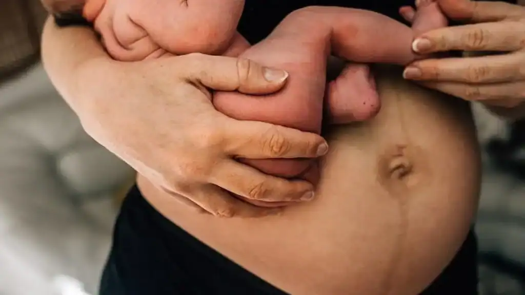 Why Is My Stomach Still Big After Pregnancy Rutherglen?